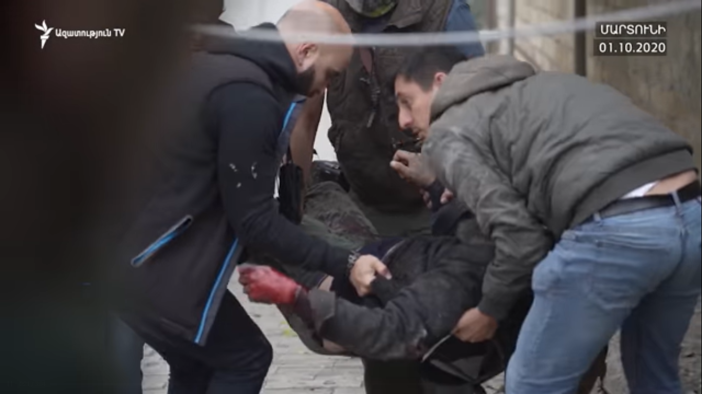 Արցախում վիրավորում ստացած հայ լրագրողները դիմել են Մարդու իրավուքների եվրոպական դատարան