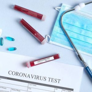Արցախում կորոնավիրուսային հիվանդության ևս 7 դեպք է գրանցվել