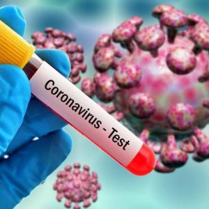 Արցախում կորոնավիրուսային հիվանդության 5 նոր դեպքեր են գրանցվել