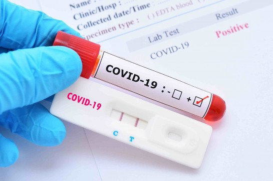 Վրաստանում վերջին օրվա ընթացքում հայտնաբերվել է COVID-19-ի 2676 նոր դեպք